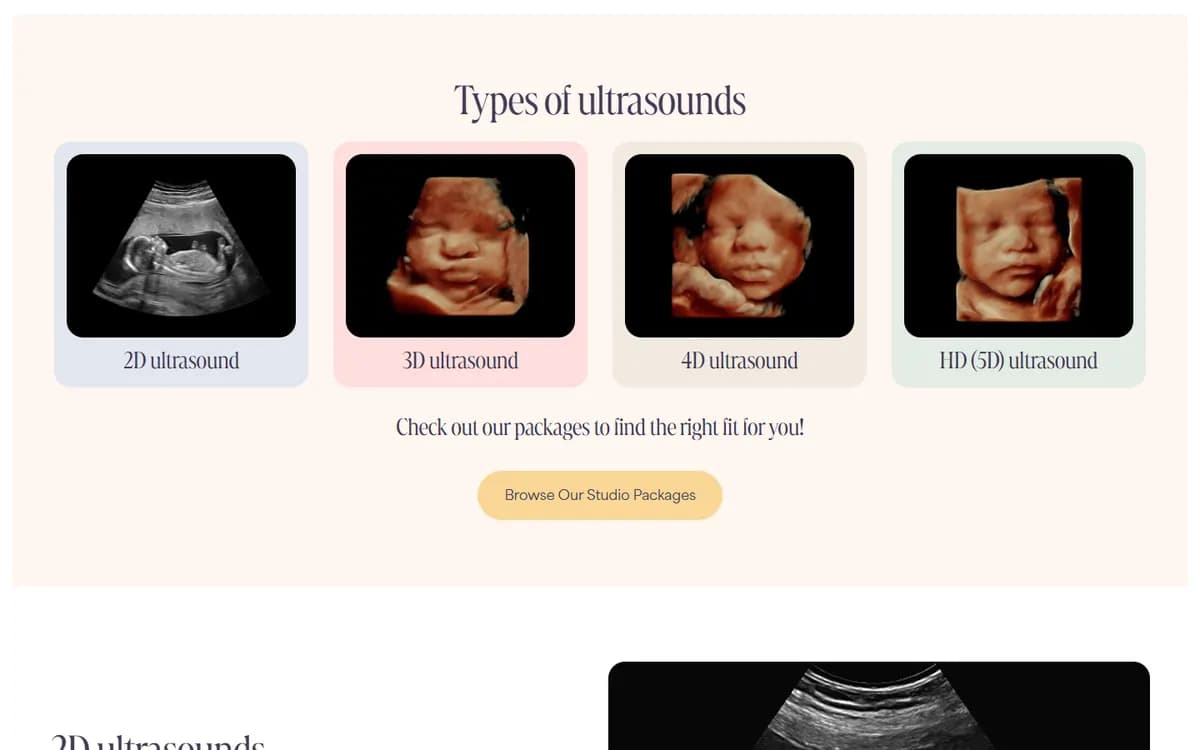 Premiere Baby Imaging: Ultrasound options, explained